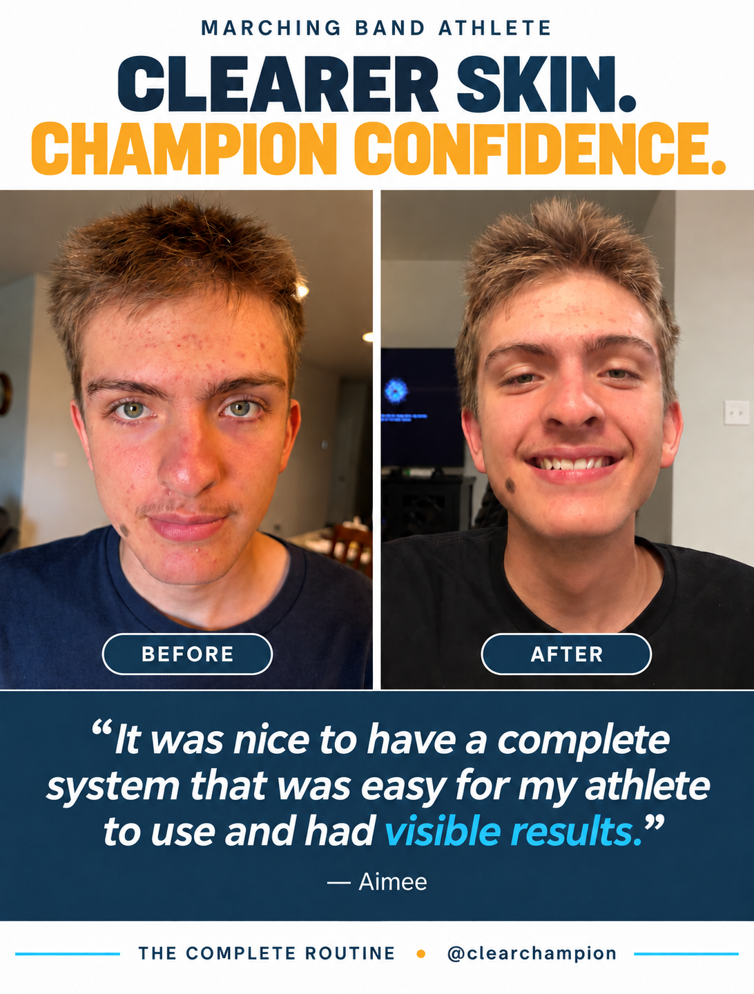 Wyatt’s existing before-and-after photos from his Clear Champion 21-Day Skin Reset